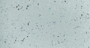 Figure 4 Fibrilation symptoms Fibrillation and fibres – What is it and how to get rid of them